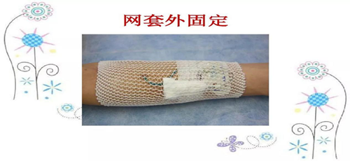 picc导管居家护理