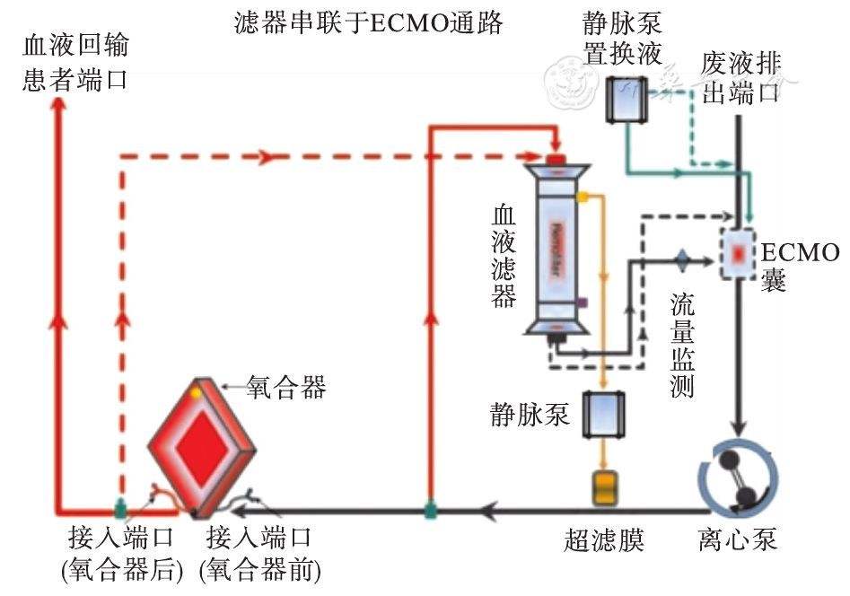 ecmo工作原理示意图