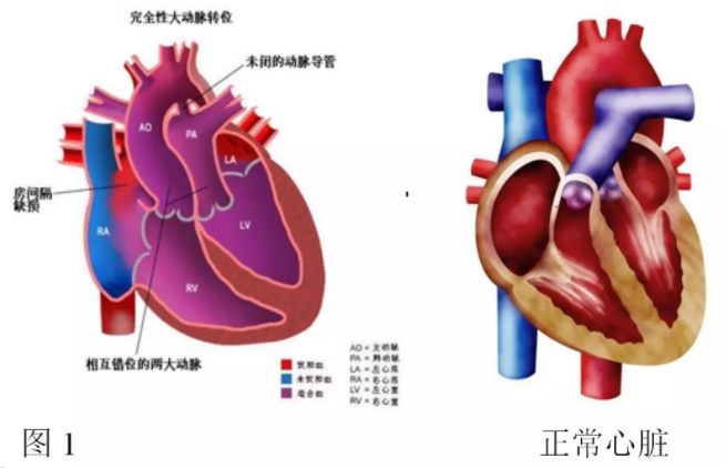 出生一天的小婴儿大动脉 错位 医生妙手 重排 最新快讯 资讯动态 阜外华中心血管病医院