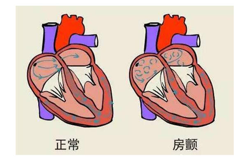 房颤时窦房结的控制功能丧失,心房激动的频率达300～600次/分,心跳