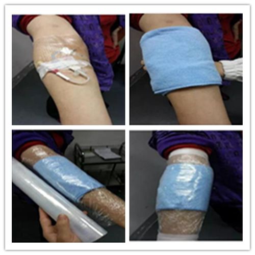 picc导管居家护理