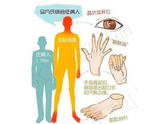 生而不凡 你有所不知的 天才 蜘蛛侠 健康科普 护理园地 阜外华中心血管病医院 生而不凡 你有所不知的 天才 蜘蛛侠 健康科普 护理园地 阜外华中心血管病医院