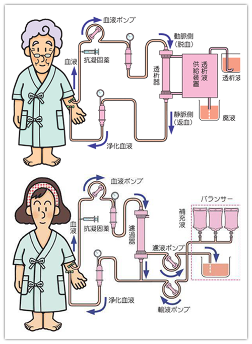 机,我还有个好听的名字叫"人工肾",能够利用弥散,对流,吸附的原理帮助