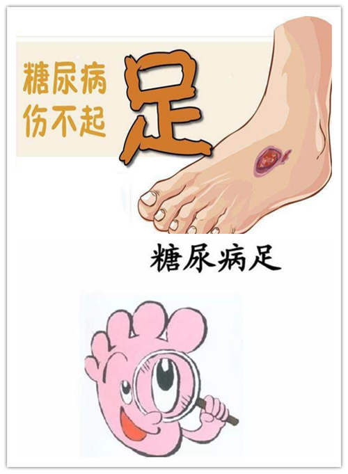 多学科合作下糖尿病足防治专家共识 版 学科动态 护理园地 阜外华中心血管病医院 多学科合作下糖尿病足防治专家共识 版 学科动态 护理园地 阜外华中心血管病医院