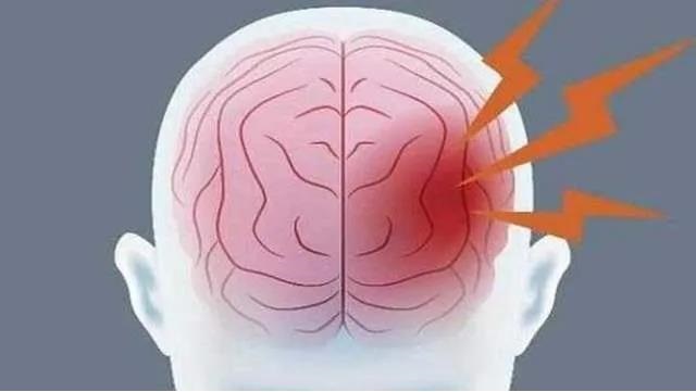 警惕"隐形杀手"硬膜下血肿,老年人病死率约2%,最实用的防范秘笈来了